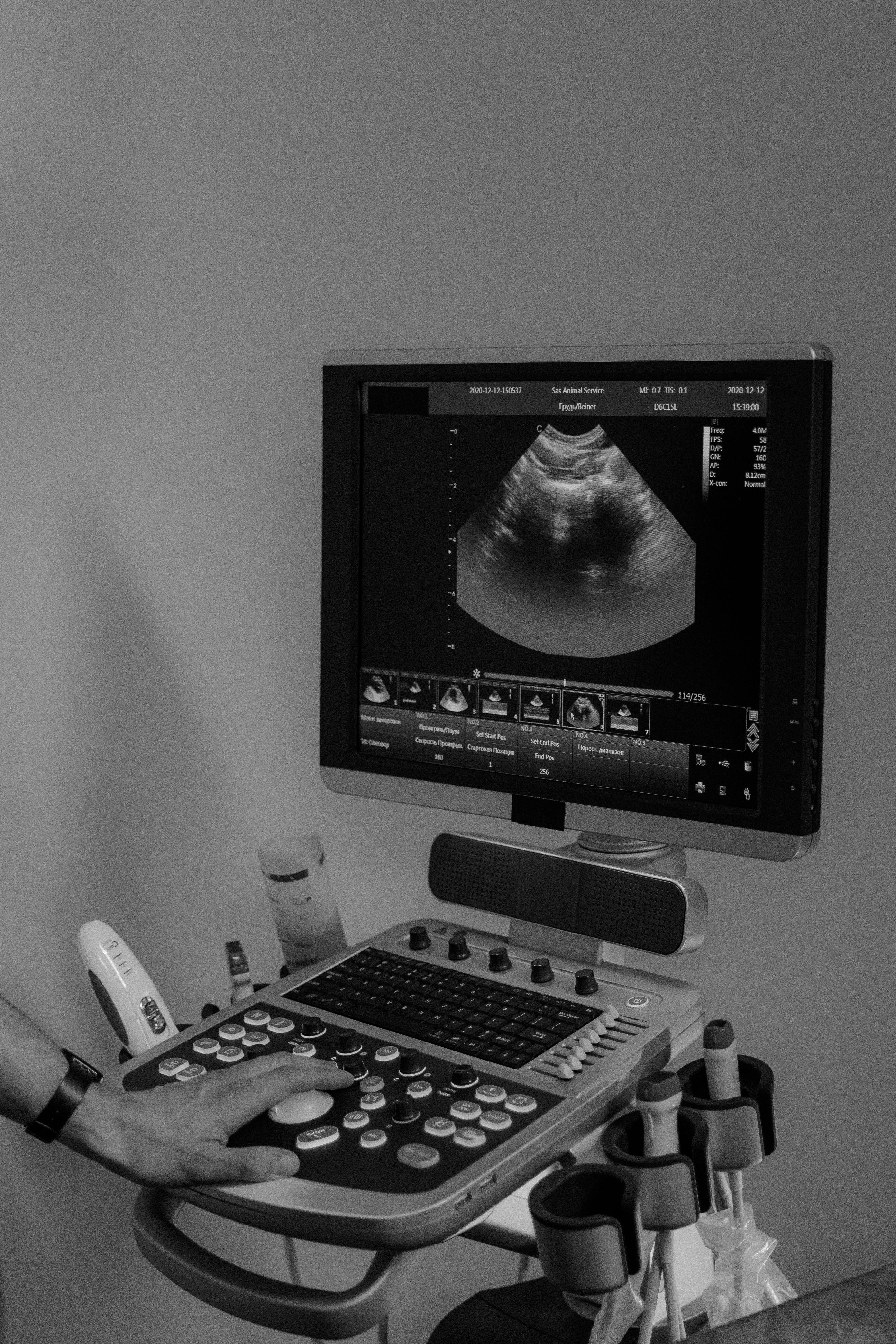 Ultrasound machine in use showing medical imaging on screen